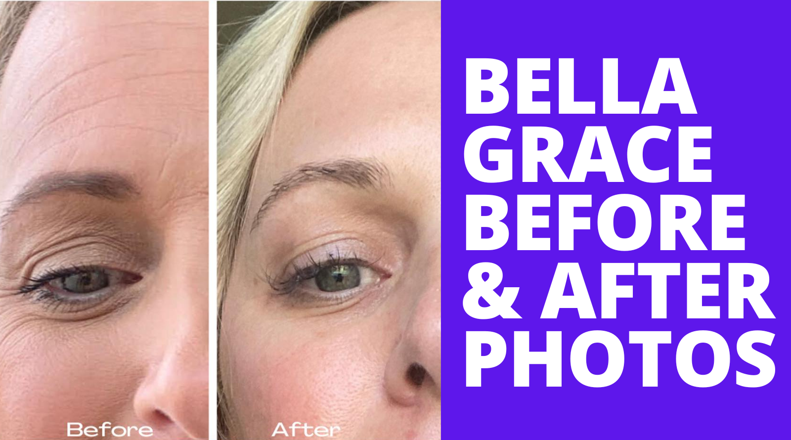 Bella Grace Collagen Elixir: Before & After Photos