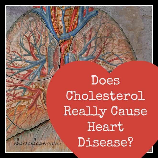cholesterol-heart-disease