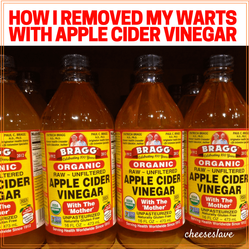 Apple Cider Vinegar for Warts: This Natural Remedy Really Works