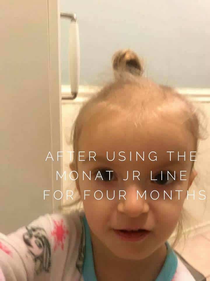 MONAT lawsuits 2018